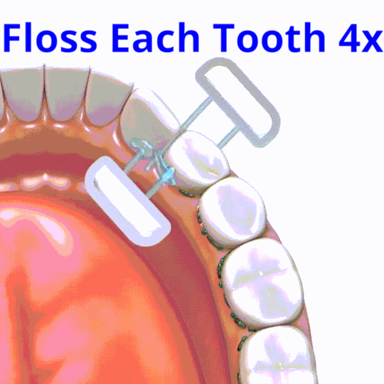 Instafloss (No Mouthpiece)